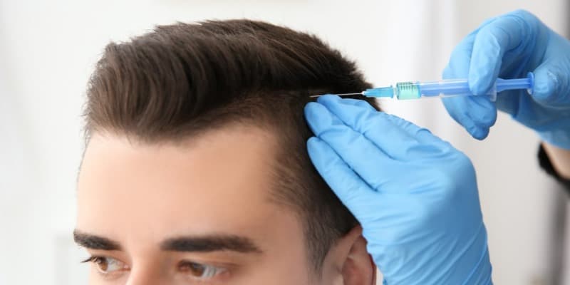 Hair Transplant UK for Men and Women – Restore Natural Growth