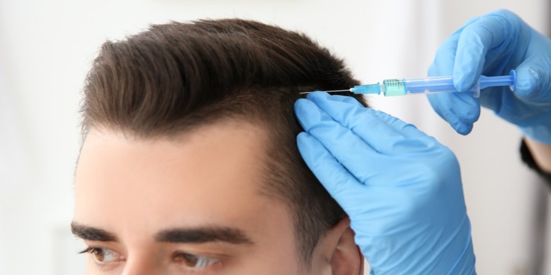 Hair Transplant UK for Men and Women – Restore Natural Growth